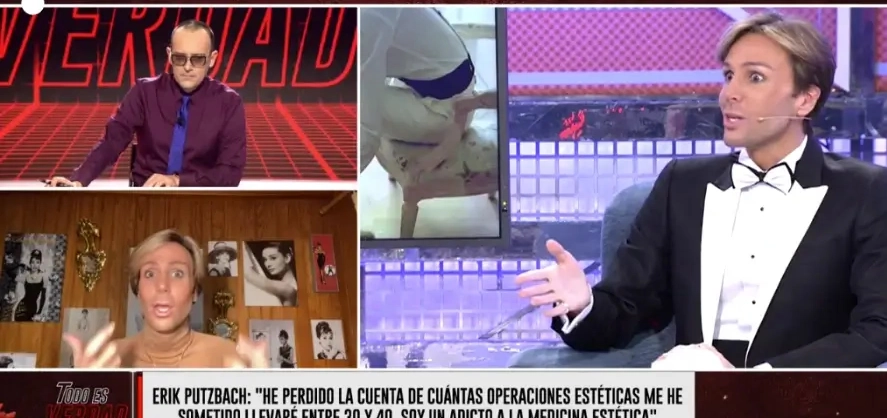 “Tudo é verdade”: Perdi a conta, já fui operado cerca de 40 vezes