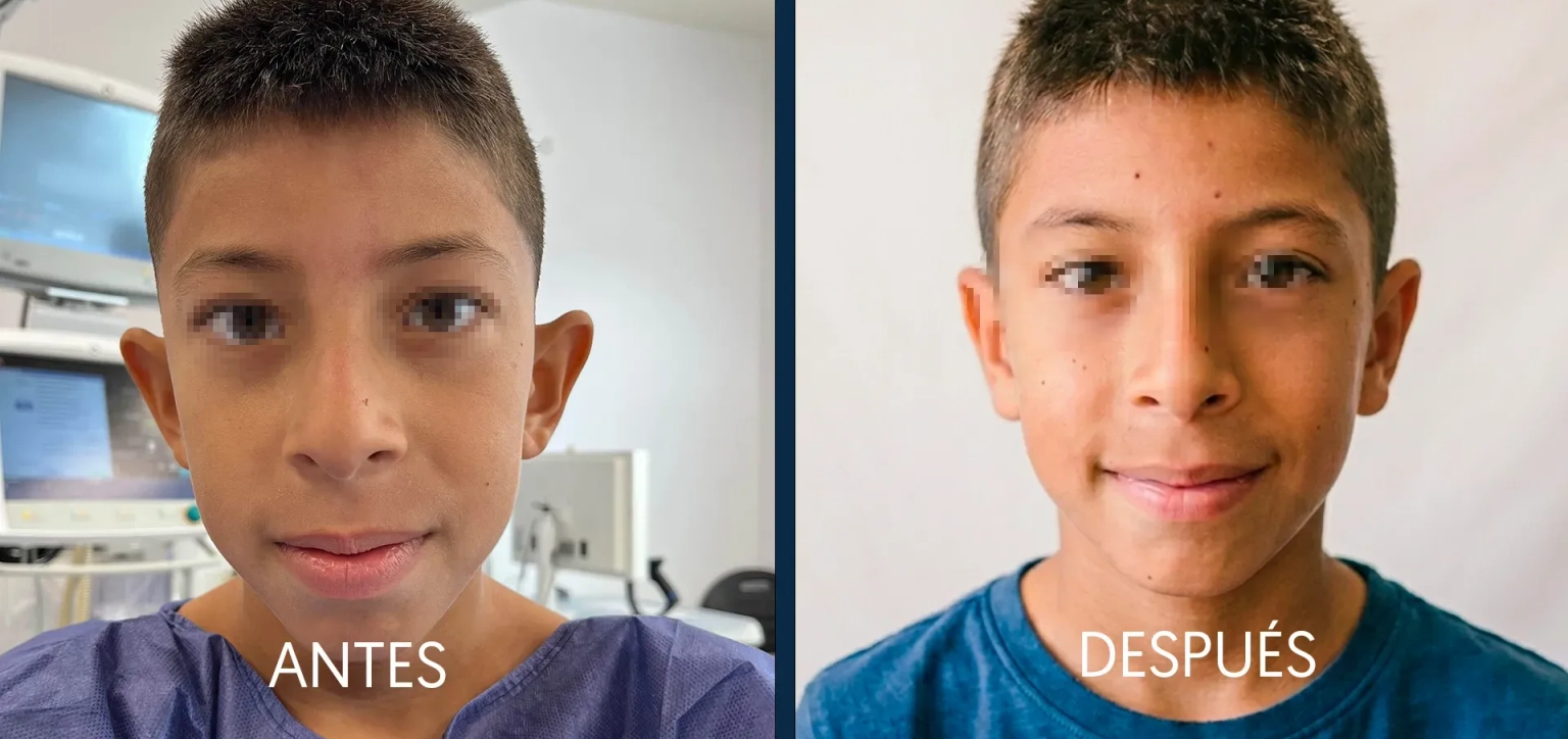 O nosso cirurgião, Santiago Elvira, explica na Antena 3 os retoques estéticos que marcam tendência