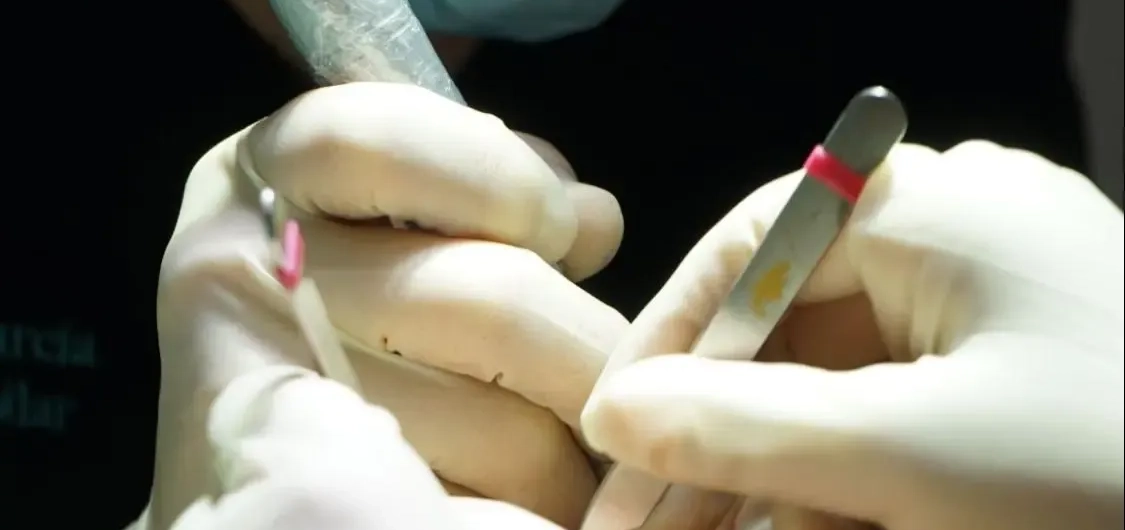 El Dr. Cristian Carrasco explica a ABC com afecta l’insomni a la salut capil·lar