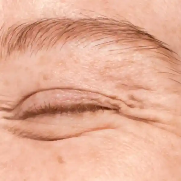 Imagen de EGOS Badalona Cirugía Plástica