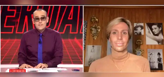 “Tudo é verdade”: Perdi a conta, já fui operado cerca de 40 vezes