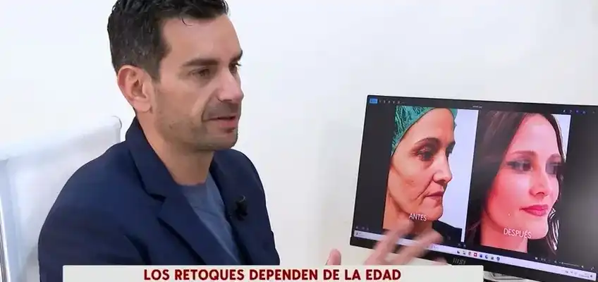 Aesthetic surgery in adults: our surgeon, Tiago Gomes, explains on Cuatro