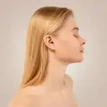 Cirugía secundaria de nariz: perfeccione su perfil nasal