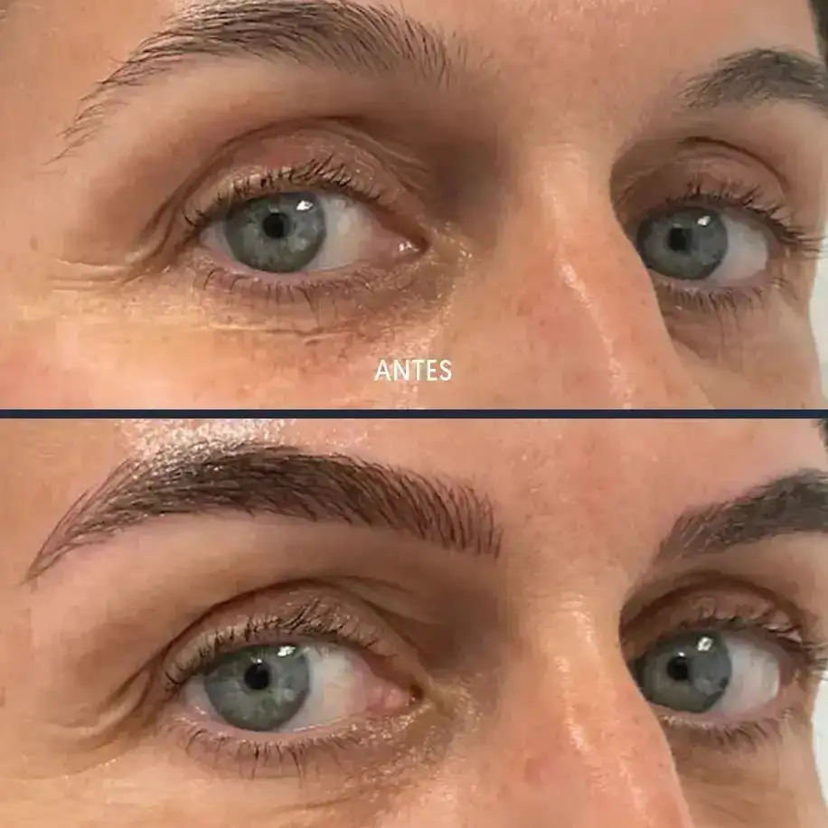 ¿Quién es el paciente Ideal para el micropigmentación de cejas sombreadas?