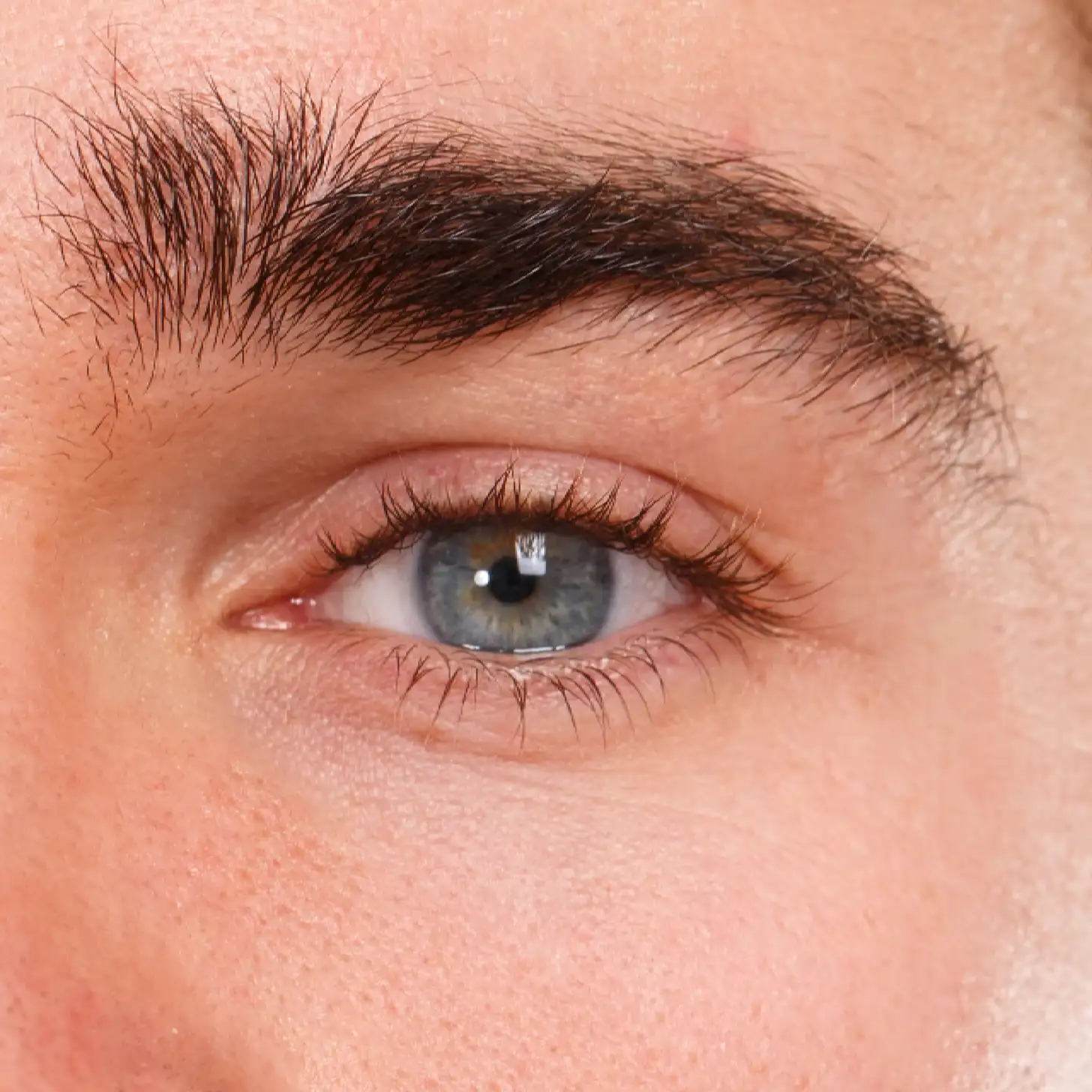 ¿Cómo se realiza el procedimiento?