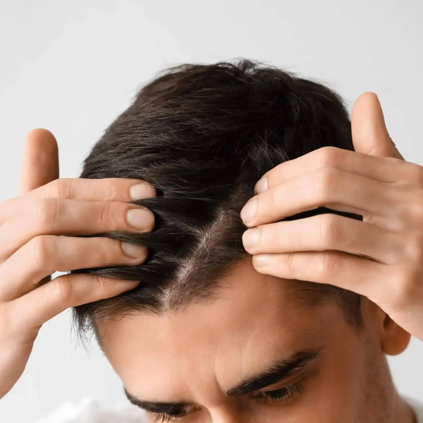 Quin és el preu d’un trasplantament capil·lar?