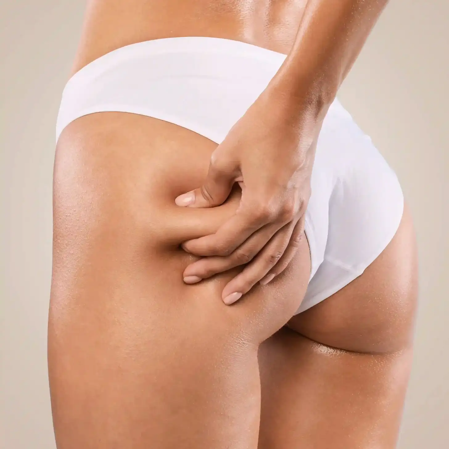 Antes y después de la Carboxiterapia