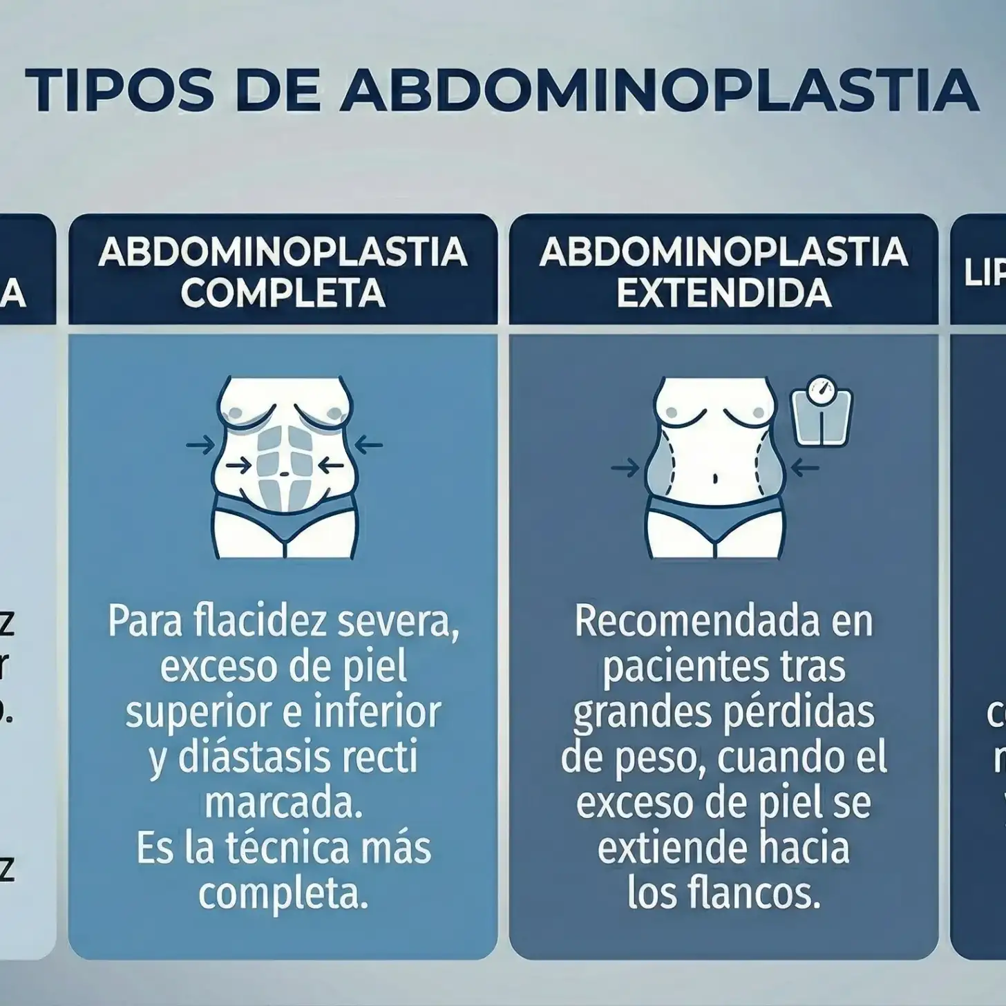 Tipos de Abdominoplastia