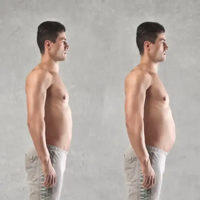 Leer información relacionada a Bajar de peso con cirugía