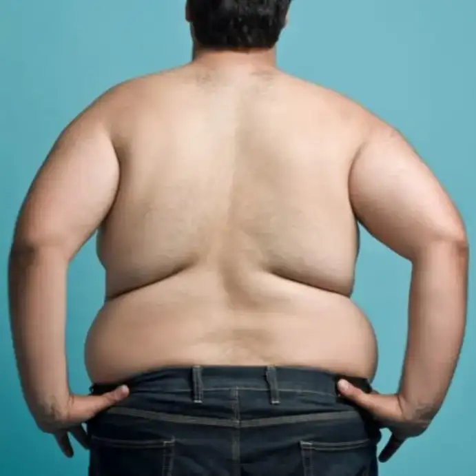 Leer información relacionada a ¿Cómo bajar peso de forma saludable y realista?