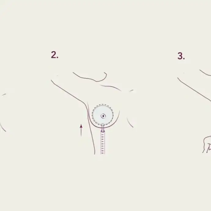 Leer información relacionada a  Preservé: la técnica minimalista que cuida tu sensibilidad mamaria