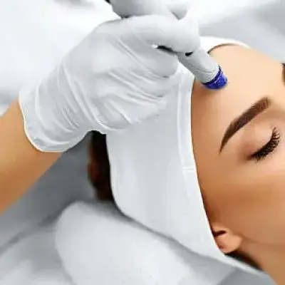 Leer información relacionada a ¿Qué es un Peeling Facial? Todo lo que necesitas saber