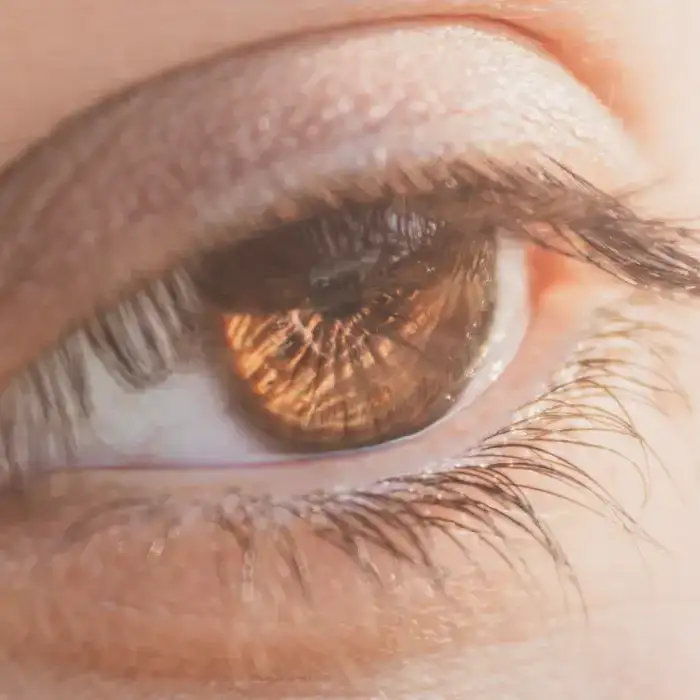 Leer información relacionada a Tiempo de recuperación de una blefaroplastia: cuánto tarda y qué esperar
