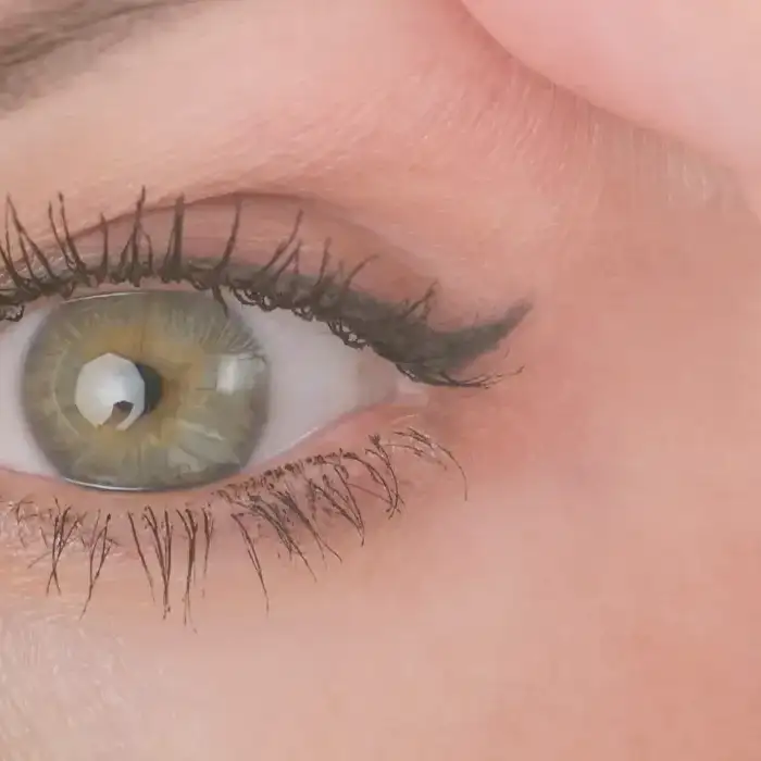 Leer información relacionada a ¿Qué es la Blefaroplastia Superior? Todo lo que necesitas saber