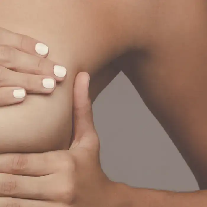 Leer información relacionada a Tiempos y duración de la operación de aumento de pecho: todo lo que debes saber