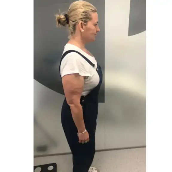 Después de Lost 28kg