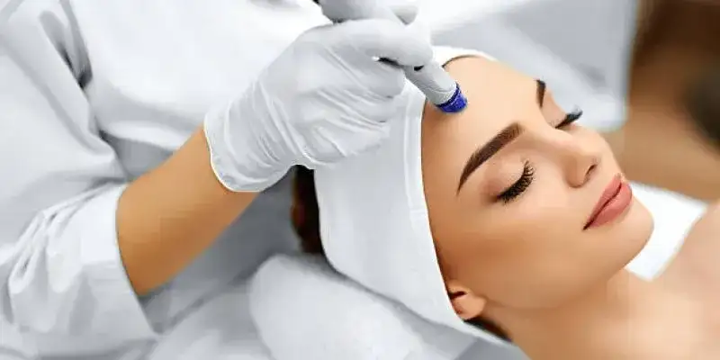 O que é um Peeling Facial? Tudo o que precisas de saber