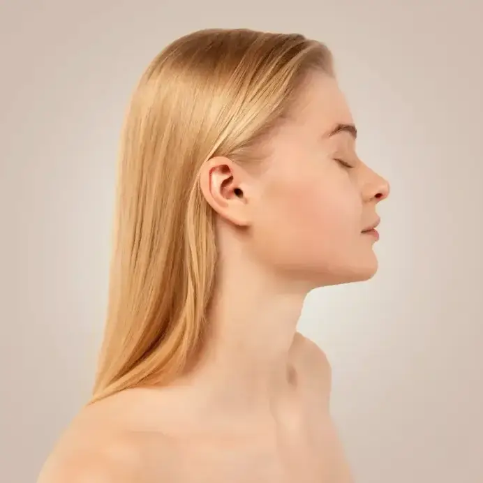 Cirugía secundaria de nariz: perfeccione su perfil nasal