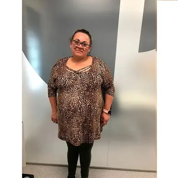 Antes de Perdió 40kg