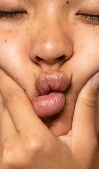 Lip hydration at Clínica EGOS