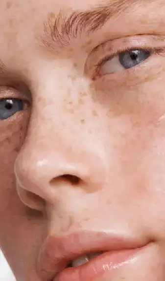 Rhinomodeling at Clínica EGOS