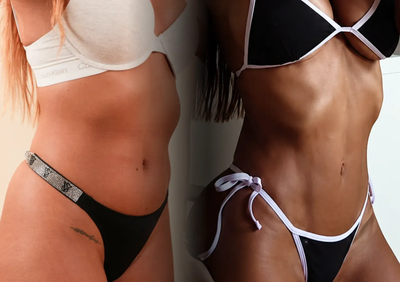 Jennifer Baldini transforma su figura con una lipotransferencia en EGOS