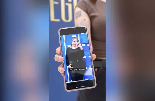 Weight loss. Anaís: From 120 kg to 60 kg with Gastric Sleeve at Clínica EGOS