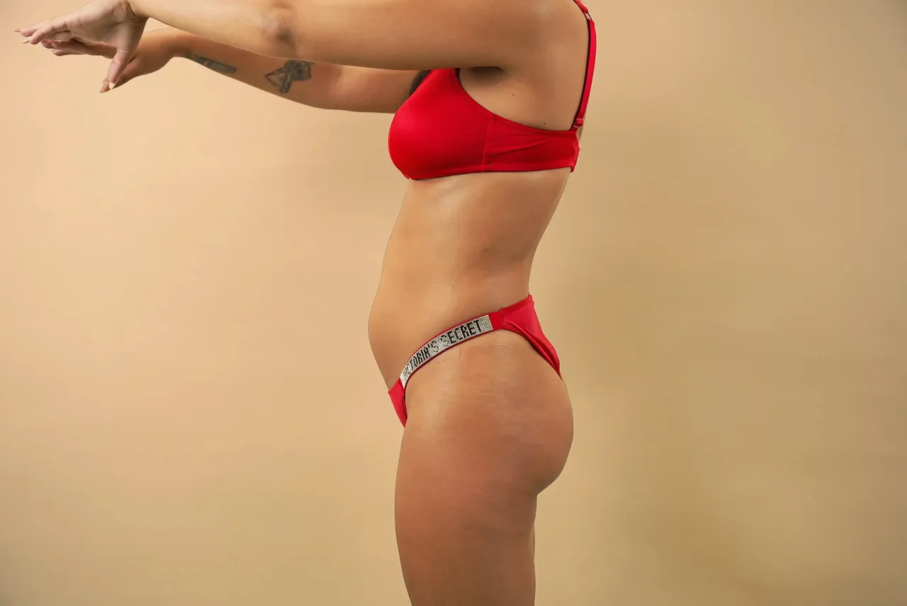 Zaira from “La Isla de las Tentaciones” has surgery