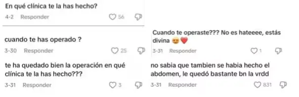 María Aguilar Brun revela o seu retoque mais comentado