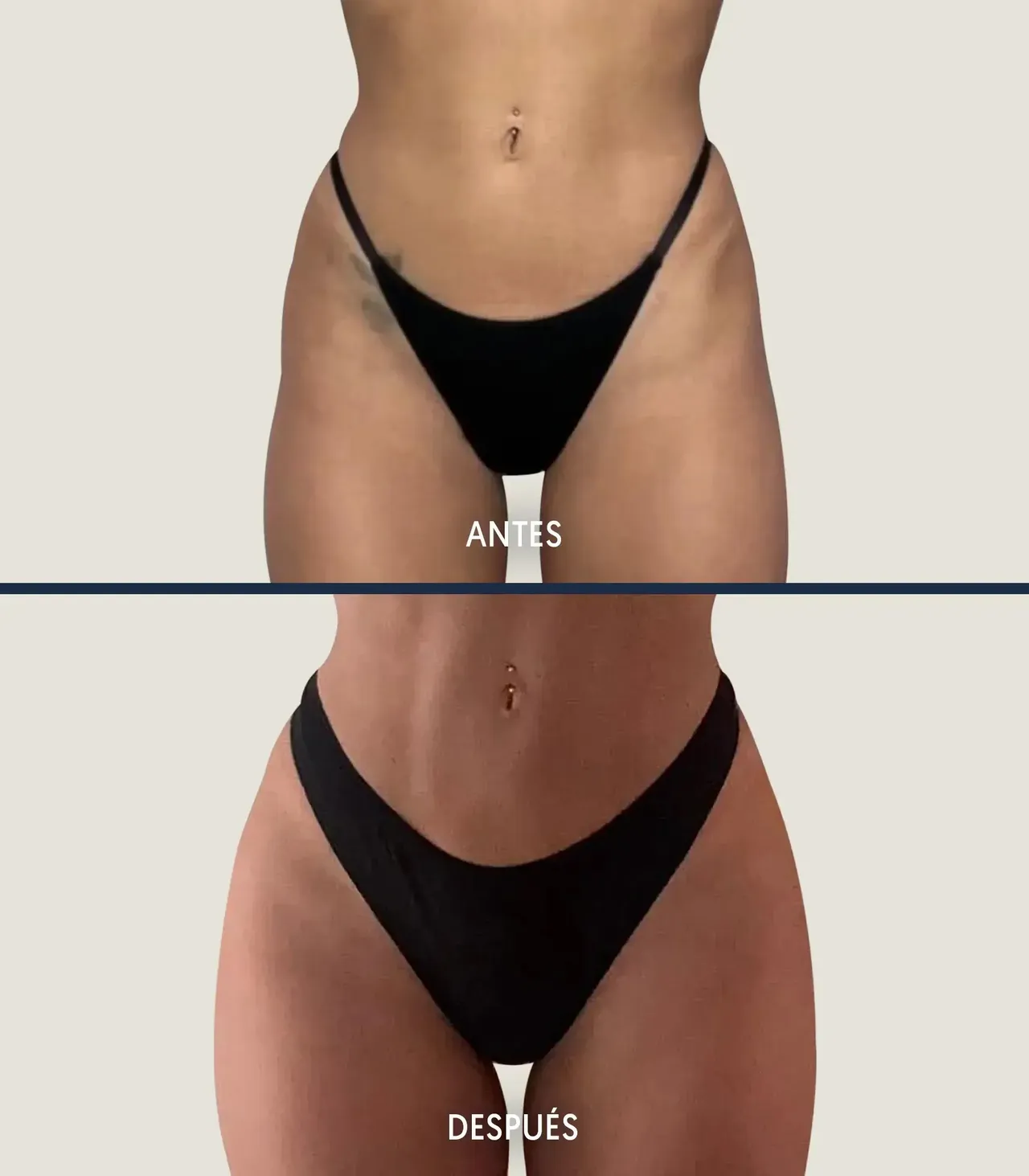 Mónica Bonilla surgeries