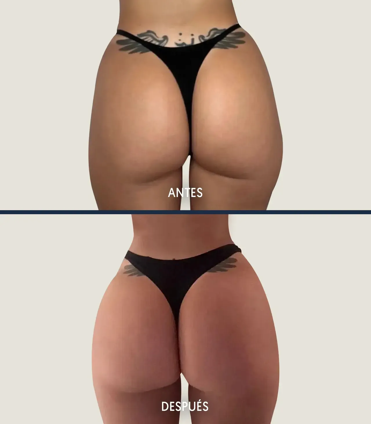 Mónica Bonilla surgeries