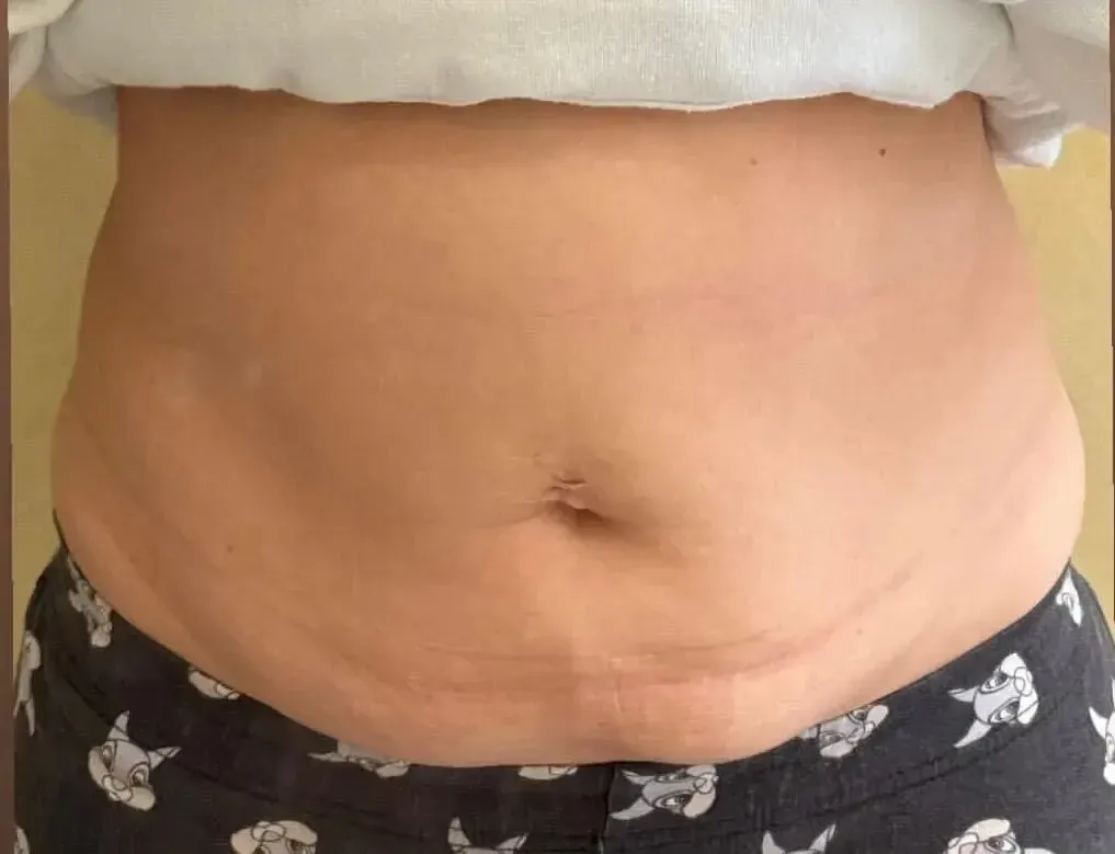 Lydia (@mylittlebigheroes) surgeries