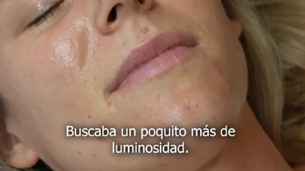 La Rocío i el seu augment de llavis