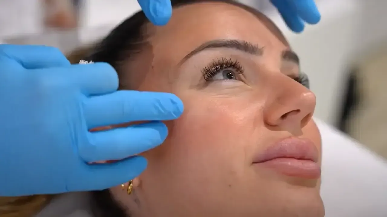 Mariona Corominas anti-wrinkle treatment