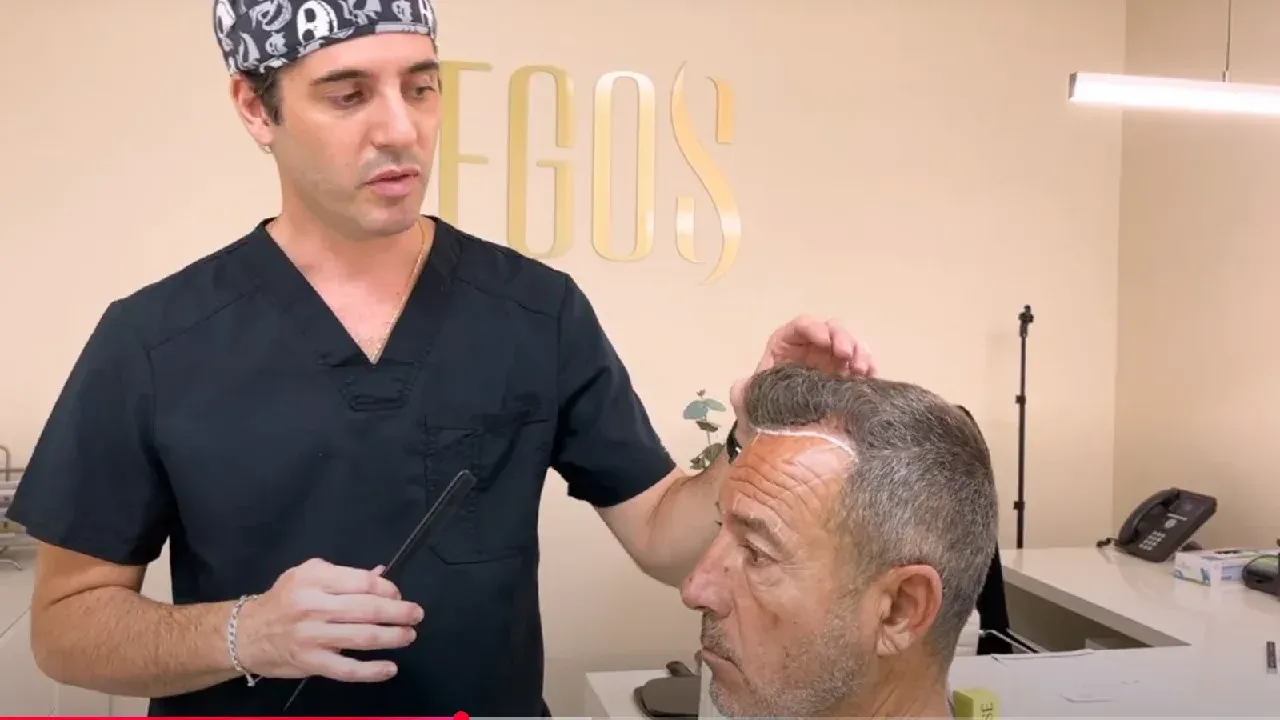 El cas d’en Carlos amb l’empelt capil·lar