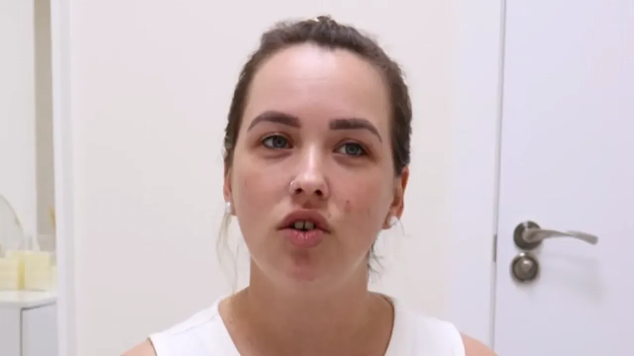 Yaiza’s result with her mastopexy