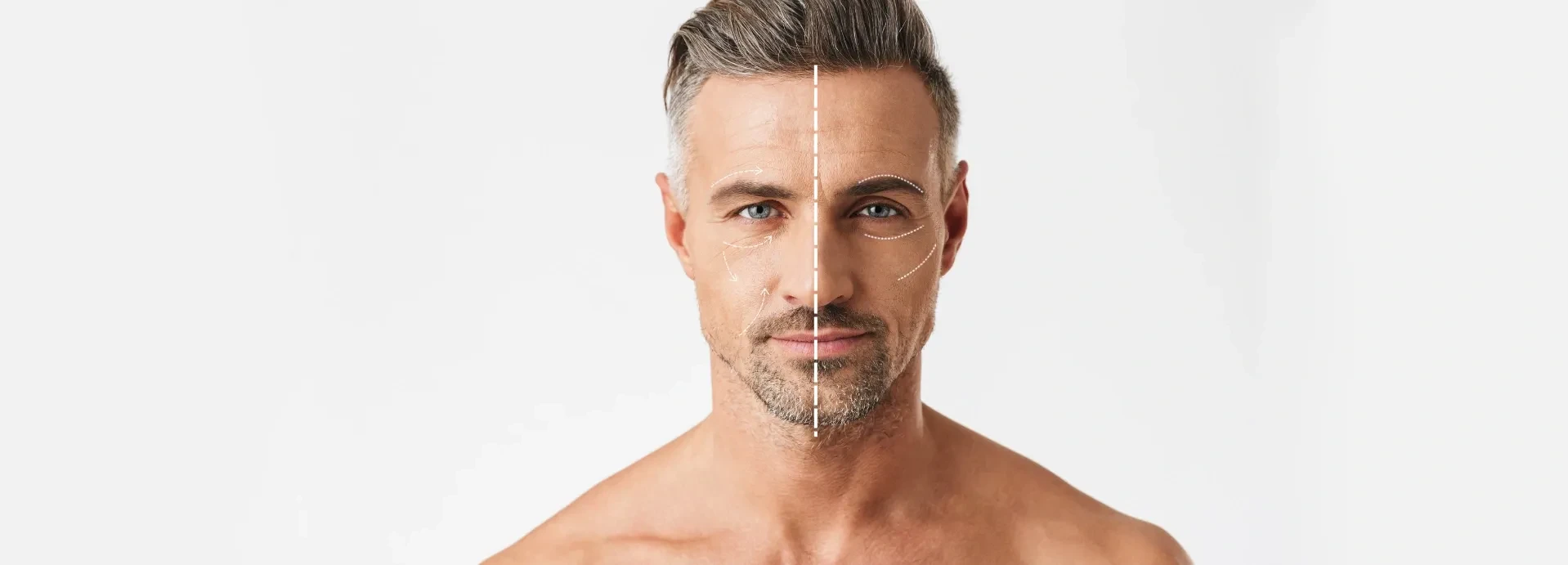 Imagem de A verdade sobre a assimetria facial