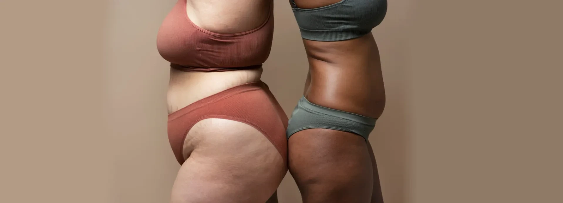 Imatge de Tot sobre el lipedema: què és i com es tracta