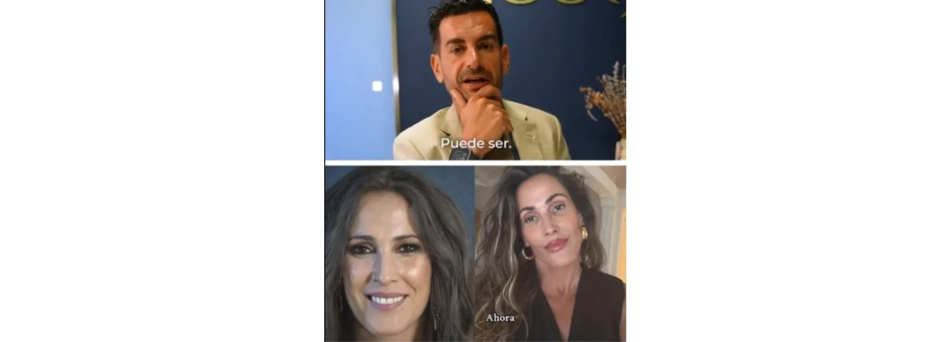 Image of What has Malú done? The professional opinion of an aesthetic doctor