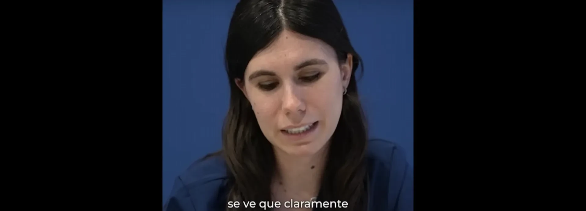 Imatge de Quines operacions té Paula Echevarría? L'opinió de la doctora