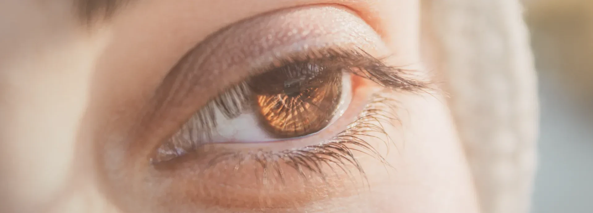 Imagem de Tempo de recuperação de uma blefaroplastia: quanto demora e o que esperar