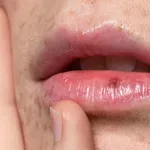 Lip hydration: Achieve more seductive lips.