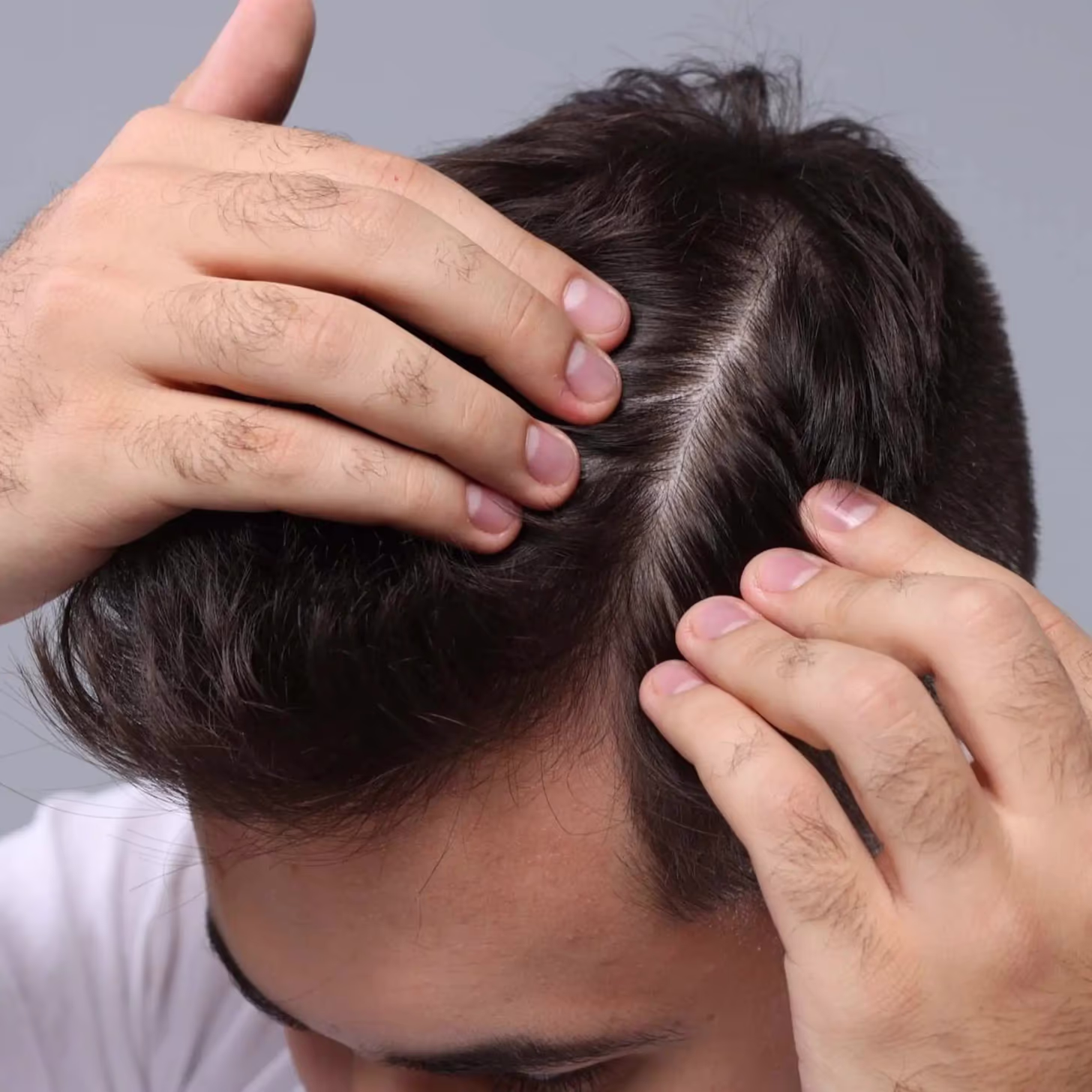 How is the procedure performed?