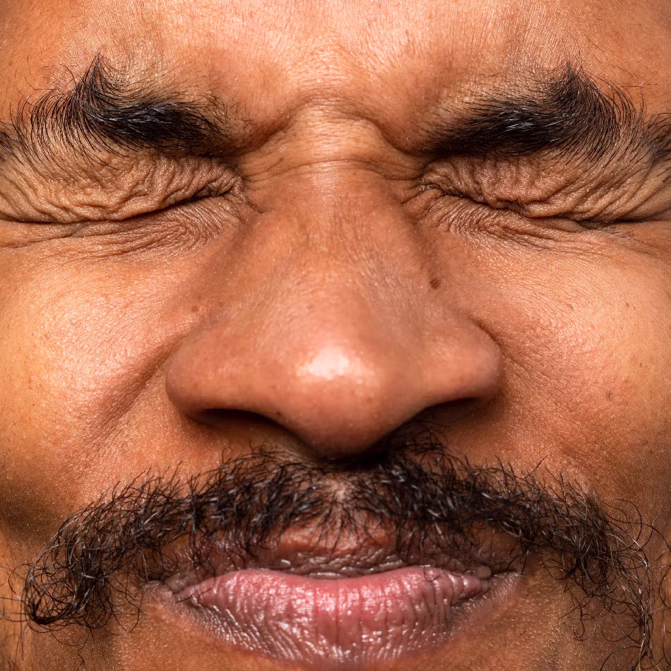 What is the cost of facial rejuvenation?