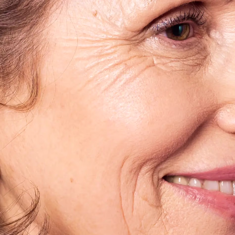 How is the procedure for eliminating expression lines performed?