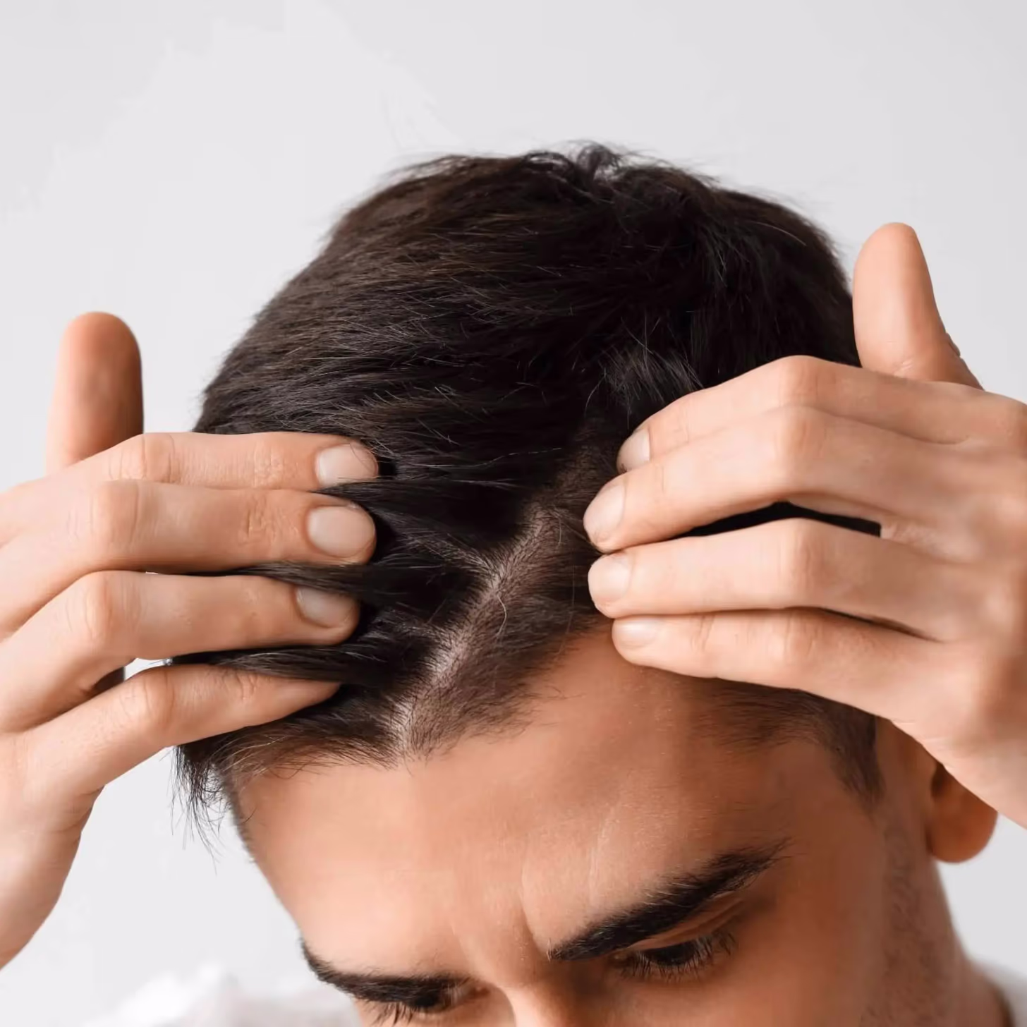 What is the price of a hair transplant?