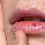 Lip hydration: Achieve more seductive lips.